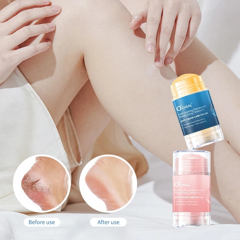 Heels - Crema anti-screpolature per piedi e talloni